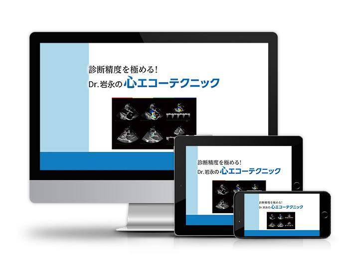 診断精度を極める！Dr.岩永の心エコーテクニック│医療情報研究所DVD